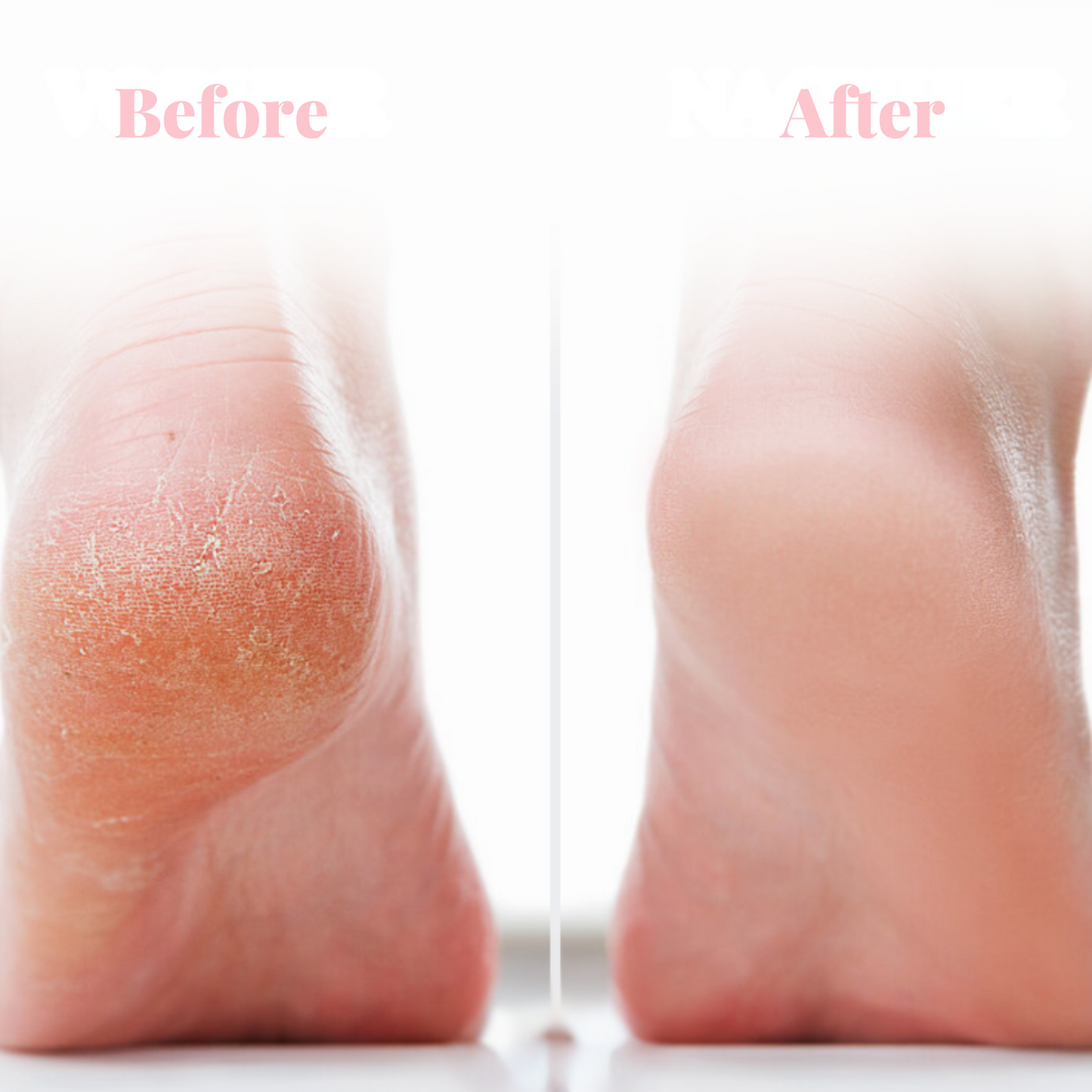 PediCare Pro ™