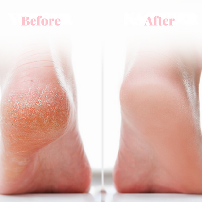 PediCare Pro ™